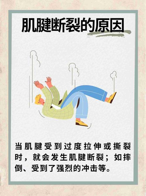 西媒:阿圭罗在业余比赛中肌腱断裂,需要接受手术